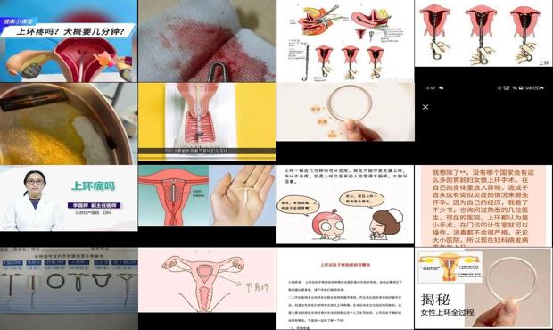 汕头上环疼不疼