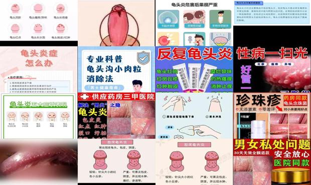 汕头龟头有炎症怎么办