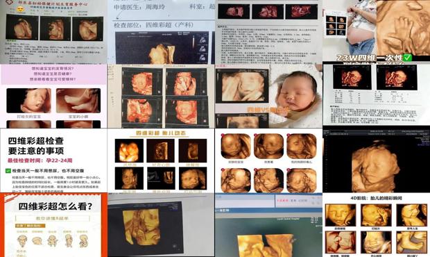 汕头胎儿四维彩超*佳时间