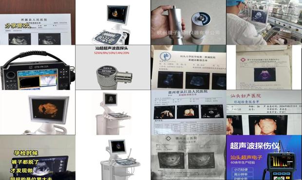 汕头彩超检查什么