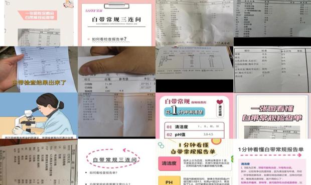 汕头白带常规检查怎么做