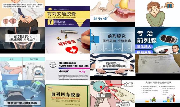 汕头前列腺炎症的治疗