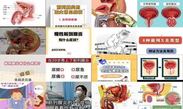 汕头前列腺炎症状是什么感觉