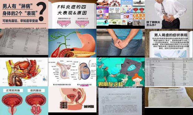 汕头男人下面有炎症是什么症状