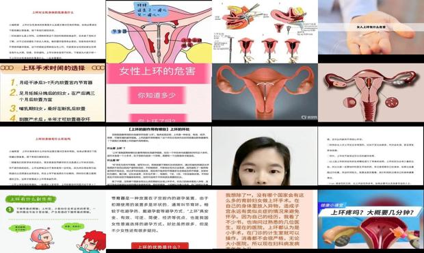 汕头女性上环的危害和*