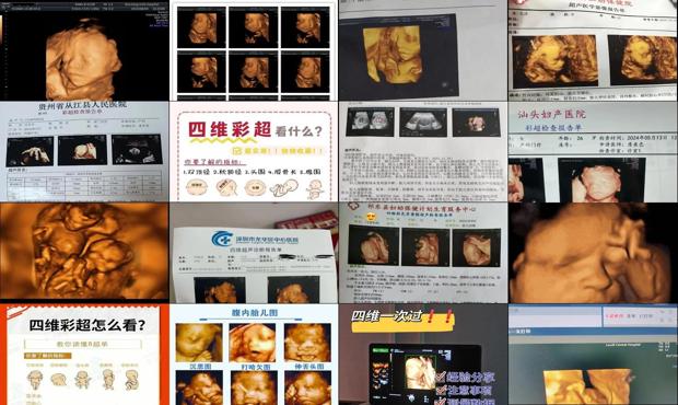 汕头怀孕几个月做四维彩超*佳