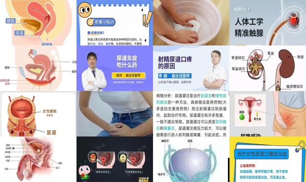 汕头尿道炎症怎么治疗