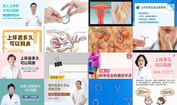 汕头女人上环多久可同房