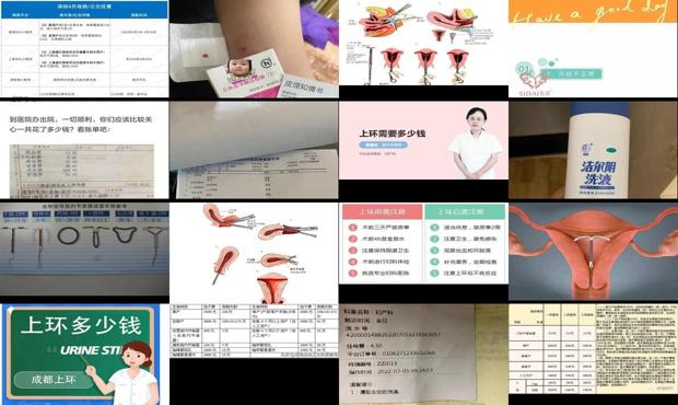 汕头*上环多少钱