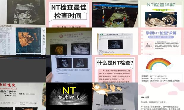 汕头nt检查多少钱