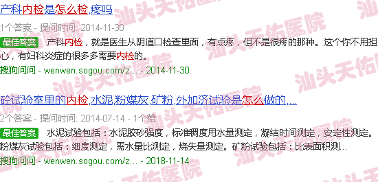 汕头内检怎么检查