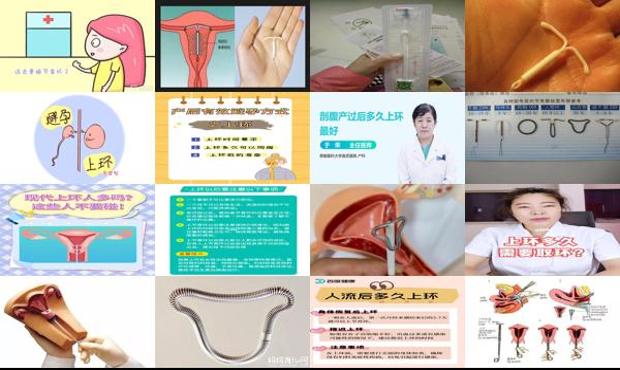 汕头生完宝宝多久能上环