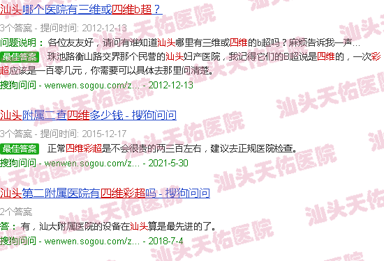 汕头孕妇的四维彩超