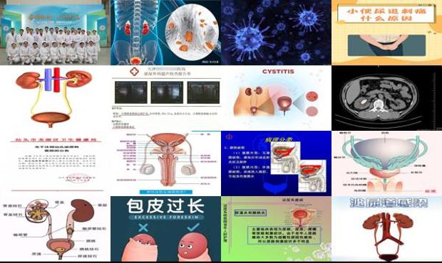 汕头泌尿系统炎症