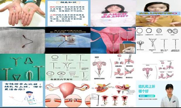 汕头女人结扎好还是上环好