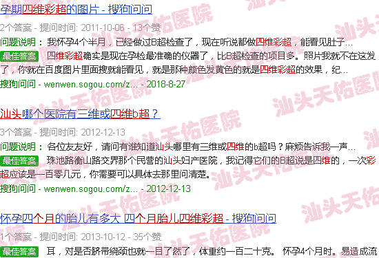 汕头三个月胎儿四维彩超图