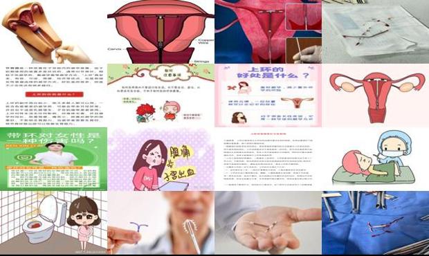 汕头女人上环的危害有哪些