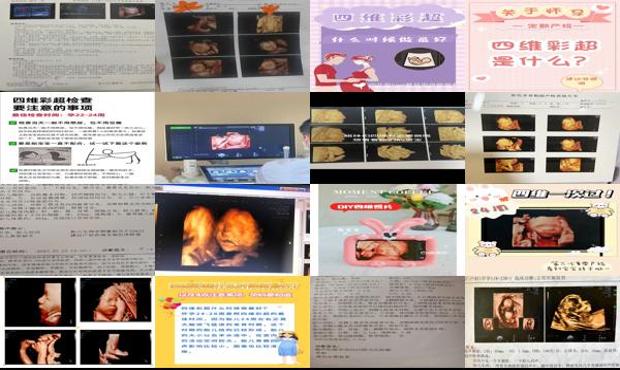 汕头四维什么时候做