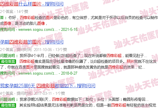 汕头四维彩超图片图