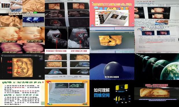 汕头四维和三维有什么区别