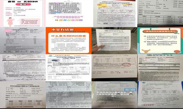 汕头*dna是检查什么的