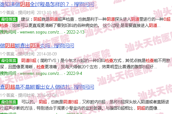 汕头阴道b超检查