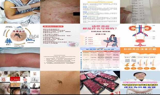 汕头炎症感染有什么症状