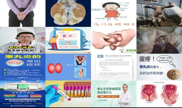 汕头皋丸炎症状