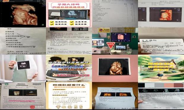 汕头四维费用多少钱