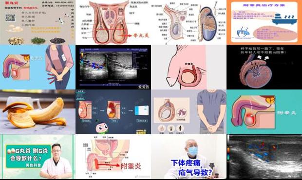 汕头附睾炎症